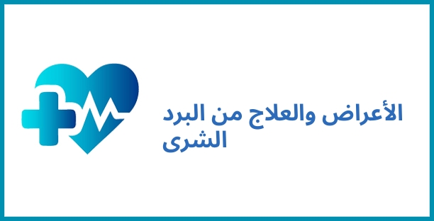 الأعراض والعلاج من البرد الشرى
