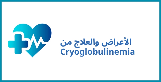 الأعراض والعلاج من Cryoglobulinemia