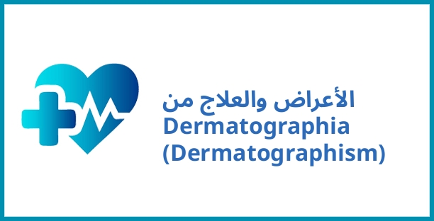 الأعراض والعلاج من Dermatographia (Dermatographism)