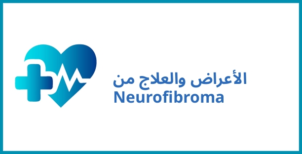 الأعراض والعلاج من Neurofibroma