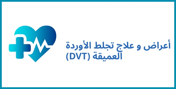 أعراض و علاج تجلط الأوردة العميقة (DVT)
