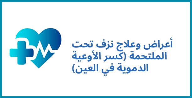 أعراض وعلاج نزف تحت الملتحمة (كسر الأوعية الدموية في العين)