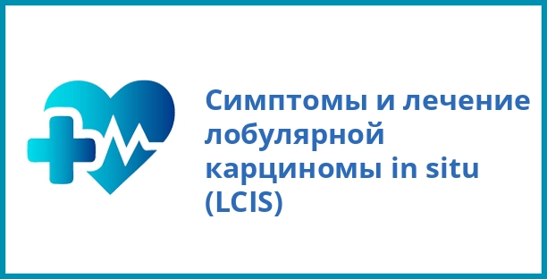Симптомы и лечение лобулярной карциномы in situ (LCIS)