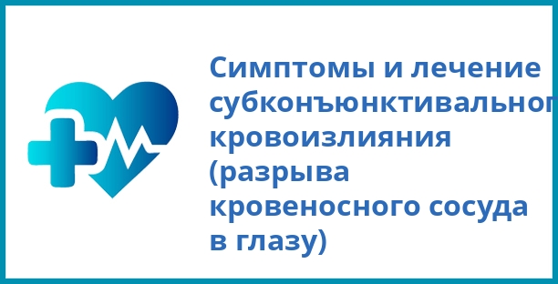 Симптомы и лечение субконъюнктивального кровоизлияния (разрыва кровеносного сосуда в глазу)